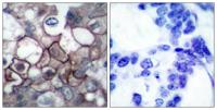 EGFR (phospho Tyr1197) Polyclonal Antibody