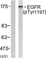 EGFR (phospho Tyr1197) Polyclonal Antibody