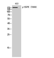 EGFR (phospho Tyr869) Polyclonal Antibody