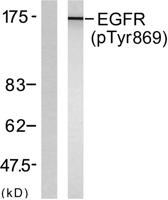 EGFR (phospho Tyr869) Polyclonal Antibody