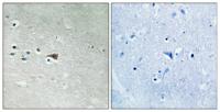 Arrestin-β-1 (phospho Ser412) Polyclonal Antibody