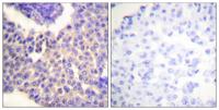 Arrestin-β-1 (phospho Ser412) Polyclonal Antibody