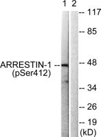 Arrestin-β-1 (phospho Ser412) Polyclonal Antibody