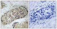 Artemis (phospho Ser516) Polyclonal Antibody