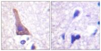 AR-β2 (phospho Ser346) Polyclonal Antibody