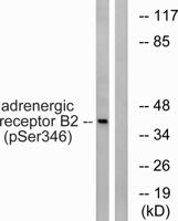 AR-β2 (phospho Ser346) Polyclonal Antibody