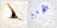 AR-β2 (phospho Ser355/S356) Polyclonal Antibody