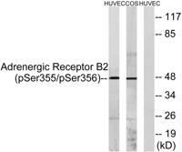 AR-β2 (phospho Ser355/S356) Polyclonal Antibody