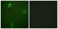 ROM-K (phospho Ser44) Polyclonal Antibody