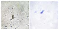 ROM-K (phospho Ser44) Polyclonal Antibody