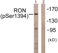 Ron (phospho Ser1394) Polyclonal Antibody