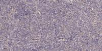 Ron (phospho Ser1394) Polyclonal Antibody