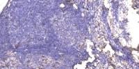 RPA p32 (phospho Ser33) Polyclonal Antibody