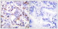 RPA32 (phospho Thr21) Polyclonal Antibody