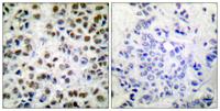 Rpb1 (phospho Ser1619) Polyclonal Antibody