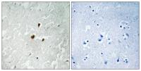 Rrn3 (phospho Ser649) Polyclonal Antibody