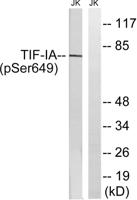 Rrn3 (phospho Ser649) Polyclonal Antibody