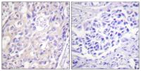 Rsk-1 (phospho Thr359/S363) Polyclonal Antibody