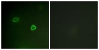 Rsk-1 (phospho Thr573) Polyclonal Antibody