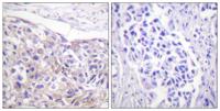 Rsk-1 (phospho Thr573) Polyclonal Antibody