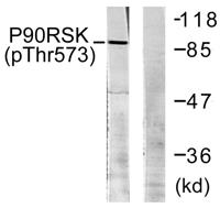 Rsk-1 (phospho Thr573) Polyclonal Antibody