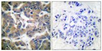 GR (phospho Ser211) Polyclonal Antibody