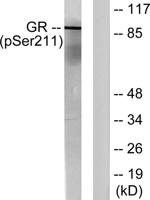 GR (phospho Ser211) Polyclonal Antibody