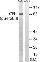 GR (phospho Ser203) Polyclonal Antibody