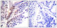GR (phospho Ser226) Polyclonal Antibody