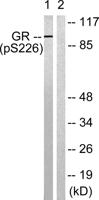 GR (phospho Ser226) Polyclonal Antibody