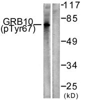 GRB10 (phospho Tyr67) Polyclonal Antibody