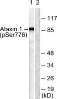 Ataxin-1 (phospho Ser776) Polyclonal Antibody