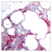 ATF-2 (phospho Ser62) Polyclonal Antibody