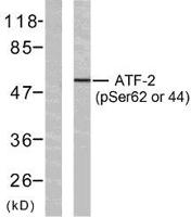 ATF-2 (phospho Ser62) Polyclonal Antibody