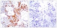 ATF-2 (phospho Thr69) Polyclonal Antibody