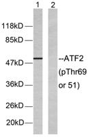 ATF-2 (phospho Thr69) Polyclonal Antibody