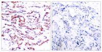 ATF-2 (phospho Thr71) Polyclonal Antibody
