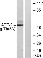 ATF-2 (phospho Thr71) Polyclonal Antibody