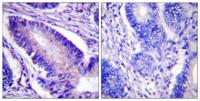 eIF4B (phospho Ser422) Polyclonal Antibody