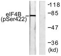 eIF4B (phospho Ser422) Polyclonal Antibody
