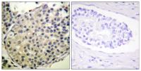 eIF4G (phospho Ser1148) Polyclonal Antibody