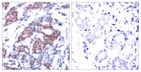 Elk-1 (phospho Ser383) Polyclonal Antibody