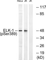Elk-1 (phospho Ser389) Polyclonal Antibody