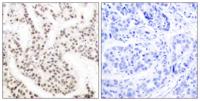 Elk-1 (phospho Thr417) Polyclonal Antibody