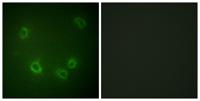 ENaC β (phospho Thr615) Polyclonal Antibody