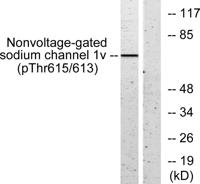ENaC β (phospho Thr615) Polyclonal Antibody