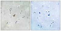 EphA3/4/5 (phospho Tyr779/833) Polyclonal Antibody