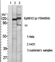 EphB1/2 (phospho Tyr594/604) Polyclonal Antibody