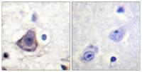 ErbB-3 (phospho Tyr1222) Polyclonal Antibody