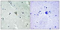ErbB-3 (phospho Tyr1328) Polyclonal Antibody